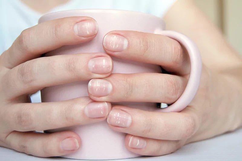 Que faire si j’ai une tache blanche sur l’ongle ? Comment s’en débarrasser ? - 23Beauty Paris