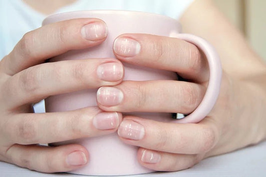 Que faire si j’ai une tache blanche sur l’ongle ? Comment s’en débarrasser ? - 23Beauty Paris
